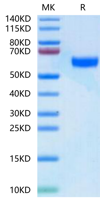 Human BDCA-2 on Tris-Bis PAGE under reduced condition. The purity is greater than 95%.Recombinant Human BDCA-2 Protein, Active