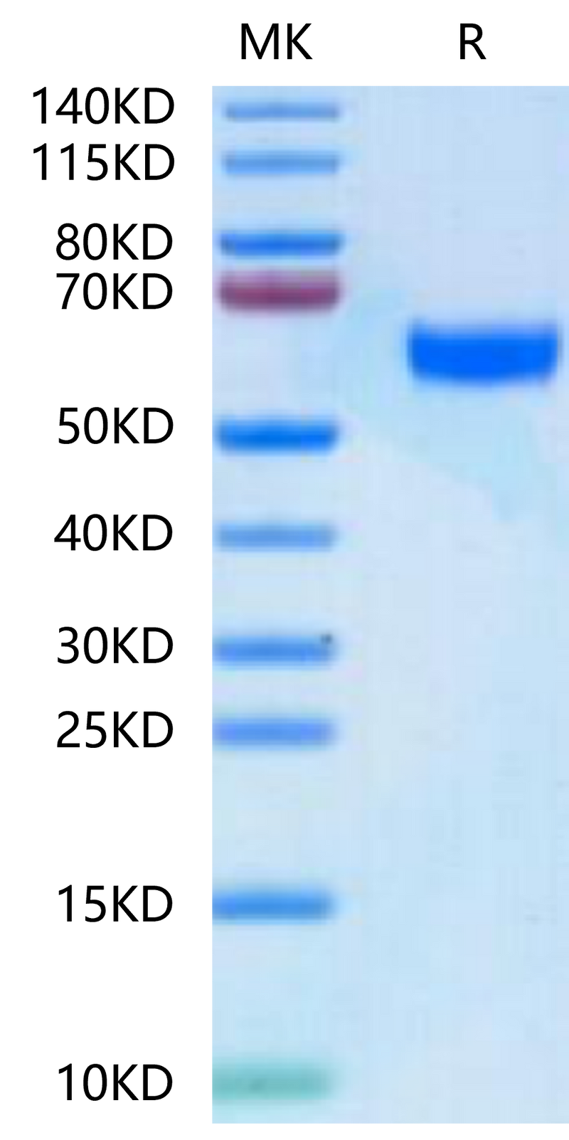Human BDCA-2 on Tris-Bis PAGE under reduced condition. The purity is greater than 95%.Recombinant Human BDCA-2 Protein, Active