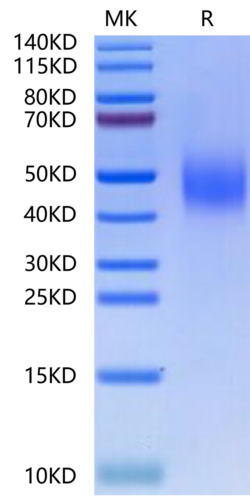 Mouse SLAMF6 on Tris-Bis PAGE under reduced condition. The purity is greater than 95%.Recombinant Mouse SLAMF6/NTB-A Protein