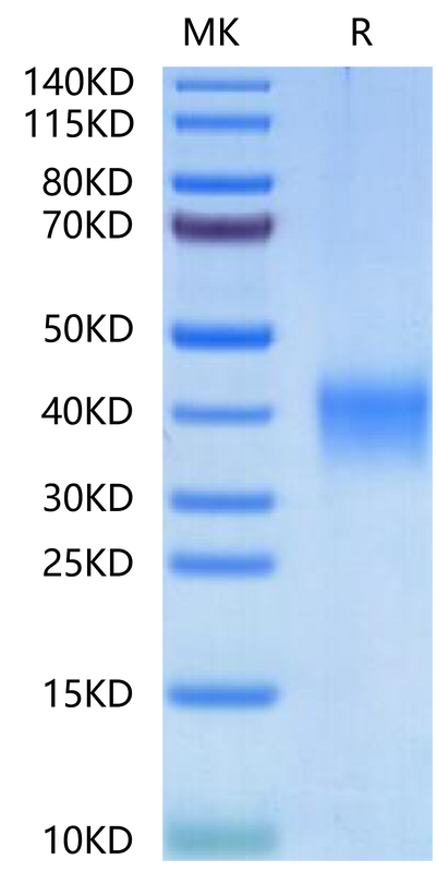 Human EPO on Tris-Bis PAGE under reduced condition. The purity is greater than 95%.Recombinant Human EPO/Erythropoietin-Protein, Active