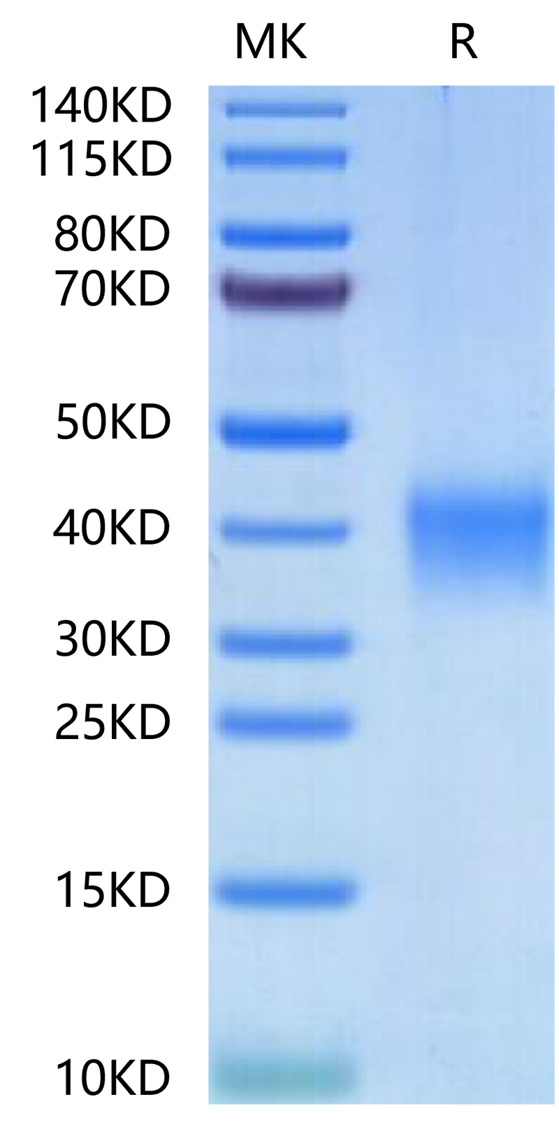 Human EPO on Tris-Bis PAGE under reduced condition. The purity is greater than 95%.Recombinant Human EPO/Erythropoietin-Protein, Active