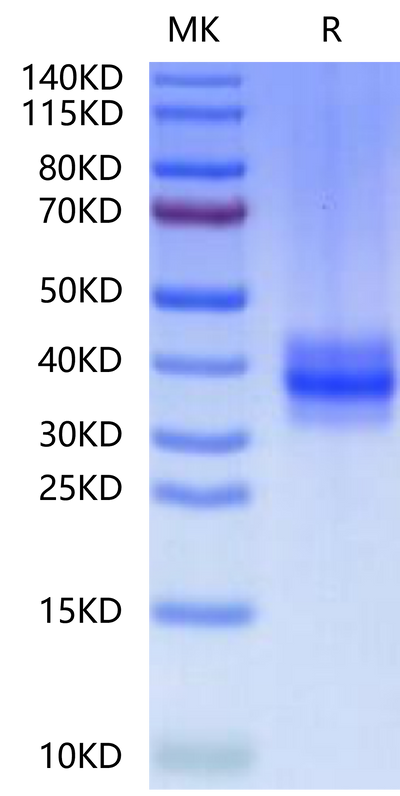 Human FOLR3 on Tris-Bis PAGE under reduced condition. The purity is greater than 95%.Recombinant Human FOLR3-Protein
