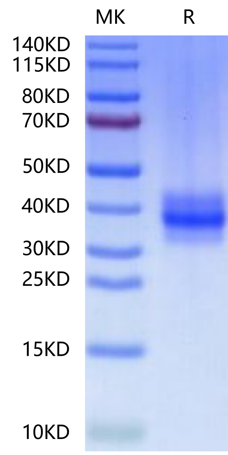 Human FOLR3 on Tris-Bis PAGE under reduced condition. The purity is greater than 95%.Recombinant Human FOLR3-Protein