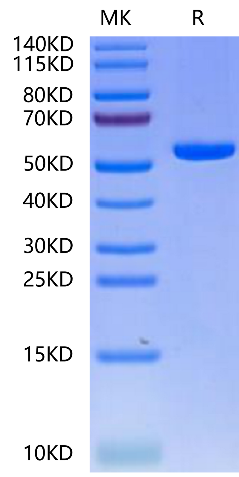 Biotinylated Human HLA-A*02:01&B2M&PRAME (SLLQHLIGL) Monomer on Tris-Bis PAGE under reduced condition. The purity is greater than 95%.Biotinylated Human HLA-A*02:01&B2M&PRAME (SLLQHLIGL) Monomer Protein
