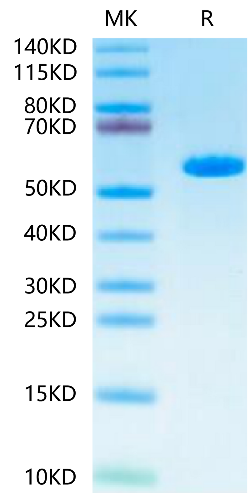 Human HLA-A*02:01&B2M&MAGE-A1 (KVLEYVIKV) Monomer -on Tris-Bis PAGE under reduced condition. The purity is greater than 95%.Recombinant Human HLA-A*02:01&B2M&MAGE-A1 (KVLEYVIKV) Monomer Protein, Active