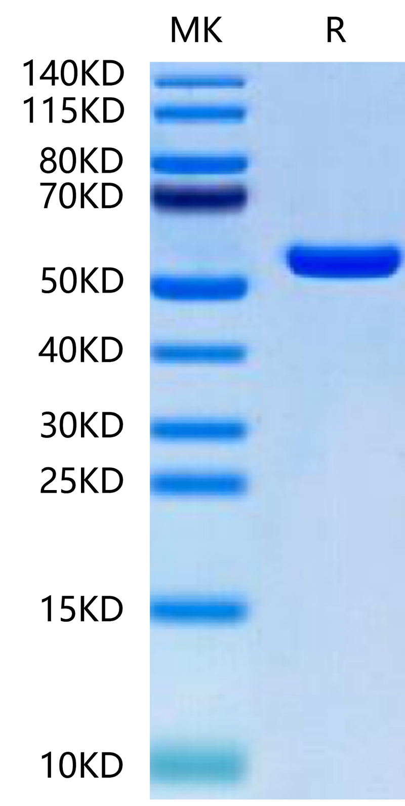 Biotinylated Human HLA-A*02:01&B2M&MAGE-A1 (KVLEYVIKV) Monomer on Tris-Bis PAGE under reduced condition. The purity is greater than 95%.Biotinylated Human HLA-A*02:01&B2M&MAGE-A1 (KVLEYVIKV) Monomer Protein