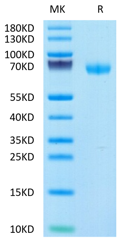 Human LIF on Tris-Bis PAGE under reduced condition. The purity is greater than 95%.Recombinant Human LIF Protein