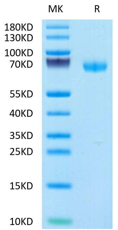 Human LIF on Tris-Bis PAGE under reduced condition. The purity is greater than 95%.Recombinant Human LIF Protein