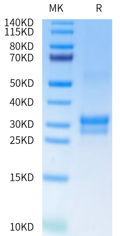 Cynomolgus/Rhesus macaque TNFSF15 on Tris-Bis PAGE under reduced condition. The purity is greater than 90%.Recombinant Cynomolgus/Rhesus macaque TNFSF15 Protein, Active