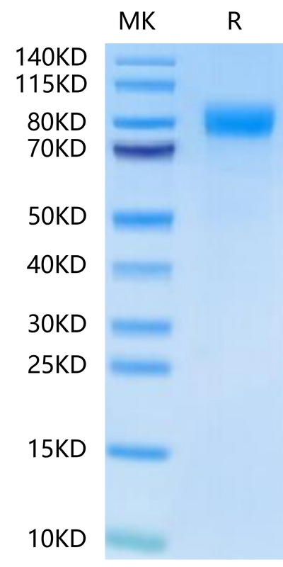 Human BCHE on Tris-Bis PAGE under reduced condition. The purity is greater than 95%.Recombinant Human BCHE/Butyrylcholinesterase-Protein