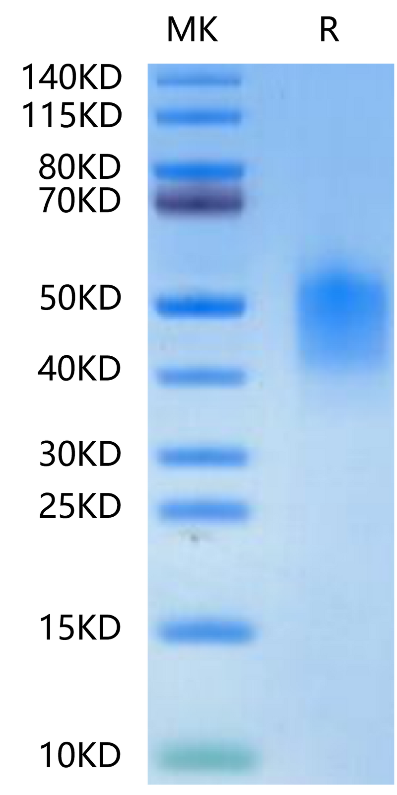 Mouse PD-L2 on Tris-Bis PAGE under reduced condition. The purity is greater than 95%.Recombinant Mouse PD-L2/B7-DC Protein, Active