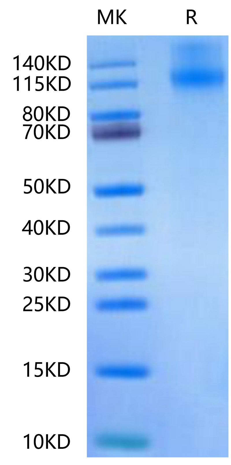 Canine OSMR on Tris-Bis PAGE under reduced condition. The purity is greater than 95%.Recombinant Canine OSMR-Protein