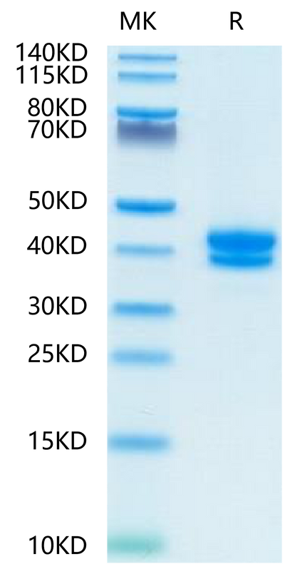FITC-Compatible Human BCMA on Tris-Bis PAGE under reduced condition. The purity is greater than 95%.Recombinant FITC-Compatible Human BCMA/TNFRSF17 Protein