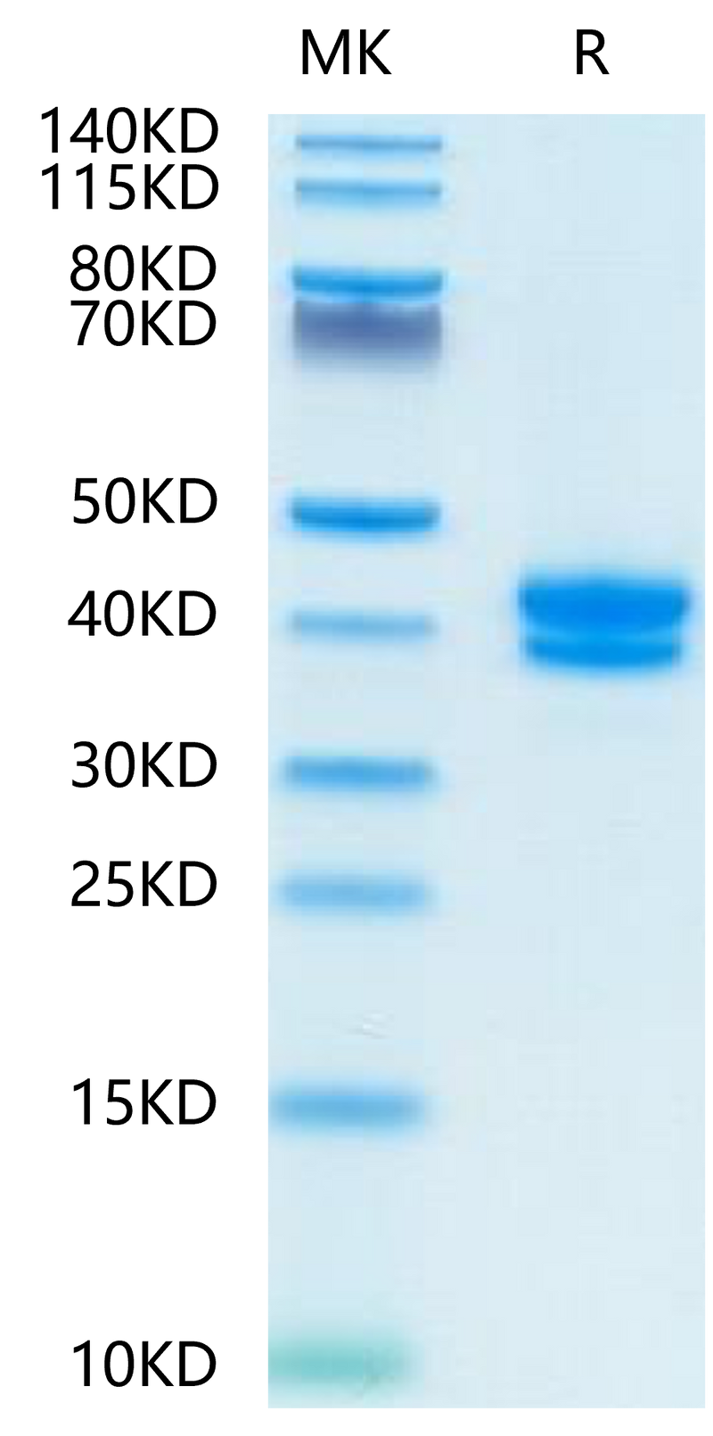 FITC-Compatible Human BCMA on Tris-Bis PAGE under reduced condition. The purity is greater than 95%.Recombinant FITC-Compatible Human BCMA/TNFRSF17 Protein