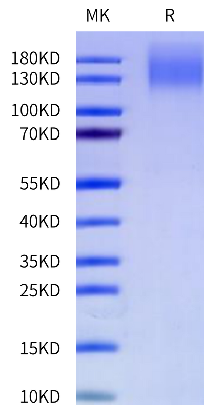 Cynomolgus CEACAM-5 on Tris-Bis PAGE under reduced condition. The purity is greater than 95%.Recombinant Cynomolgus CEACAM-5/CD66e Protein