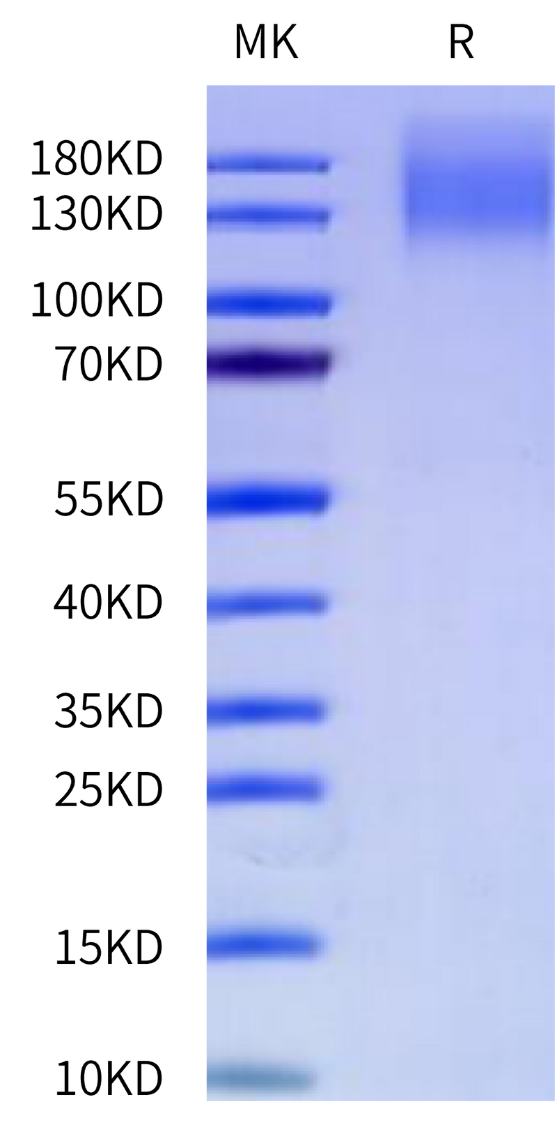 Cynomolgus CEACAM-5 on Tris-Bis PAGE under reduced condition. The purity is greater than 95%.Recombinant Cynomolgus CEACAM-5/CD66e Protein