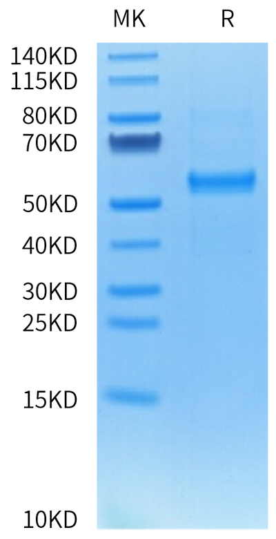 Cynomolgus DLL3 on Tris-Bis PAGE under reduced condition. The purity is greater than 95%.Recombinant Cynomolgus DLL3 Protein, Active