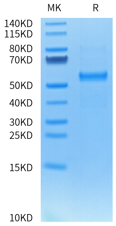 Cynomolgus DLL3 on Tris-Bis PAGE under reduced condition. The purity is greater than 95%.Recombinant Cynomolgus DLL3 Protein, Active