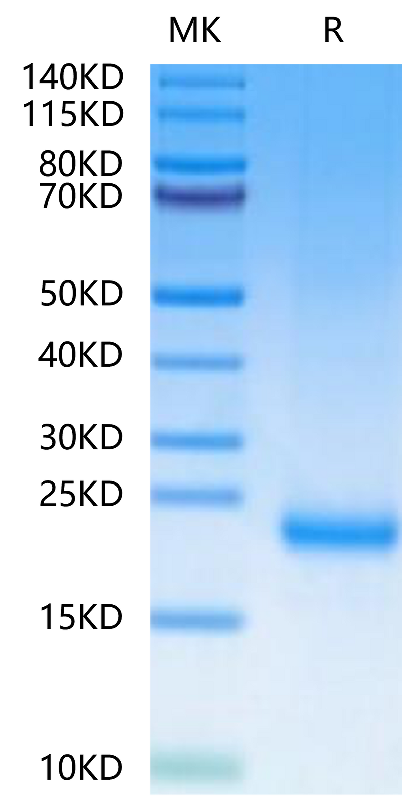 Mouse MOG on Tris-Bis PAGE under reduced condition. The purity is greater than 95%.Recombinant Mouse MOG/Myelin Oligodendrocyte Glycoprotein Protein