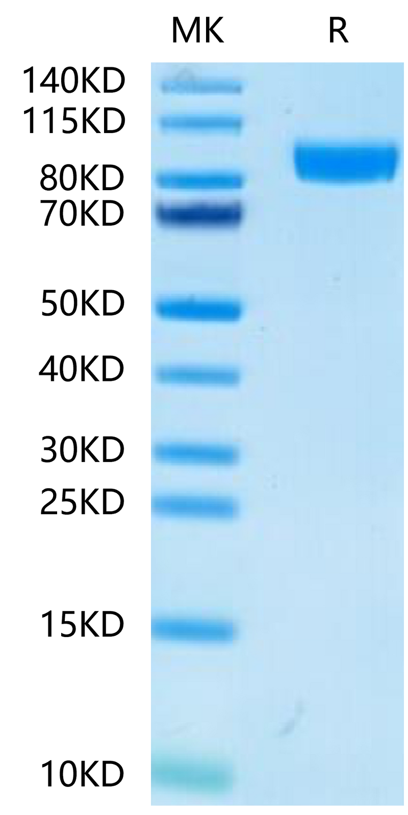 Mouse gp130 on Tris-Bis PAGE under reduced condition. The purity is greater than 95%.Recombinant Mouse gp130/CD130/IL-6 R beta Protein