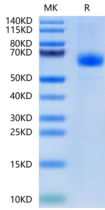 Human CDH17 Domain 3&4 on Tris-Bis PAGE under reduced condition. The purity is greater than 95%.Recombinant Human CDH17/Cadherin 17 Domain 3&4 Protein