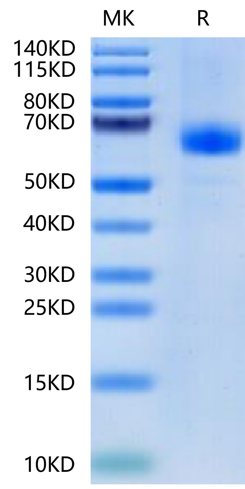 Human CDH17 Domain 3&4 on Tris-Bis PAGE under reduced condition. The purity is greater than 95%.Recombinant Human CDH17/Cadherin 17 Domain 3&4 Protein