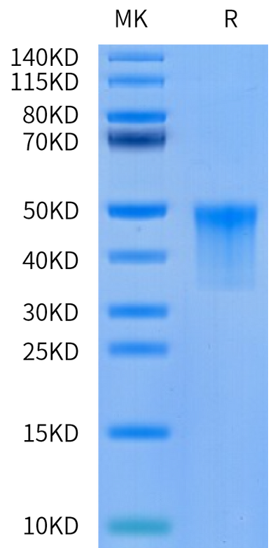 Cynomolgus VSIG4 on Tris-Bis PAGE under reduced condition. The purity is greater than 95%.Recombinant Cynomolgus VSIG4 Protein