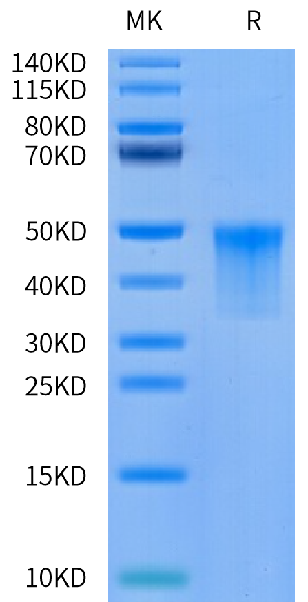 Cynomolgus VSIG4 on Tris-Bis PAGE under reduced condition. The purity is greater than 95%.Recombinant Cynomolgus VSIG4 Protein