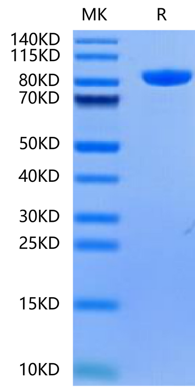 Human Alkaline Phosphatase (Germ type) on Tris-Bis PAGE under reduced condition. The purity is greater than 95%.Recombinant Human Alkaline Phosphatase (Germ type) /ALPG Protein, Active