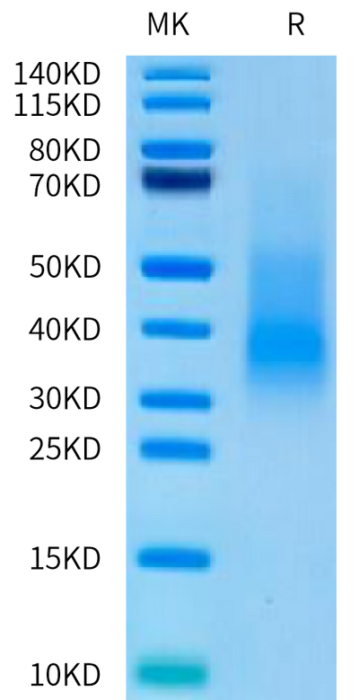 Human RANKL on Tris-Bis PAGE under reduced condition. The purity is greater than 90%.Recombinant Human RANKL/TNFSF11/CD254 Protein, Active