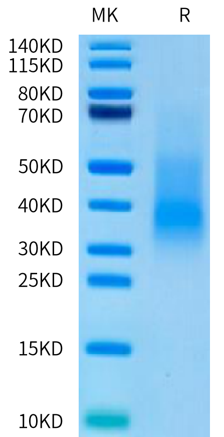 Human RANKL on Tris-Bis PAGE under reduced condition. The purity is greater than 90%.Recombinant Human RANKL/TNFSF11/CD254 Protein, Active