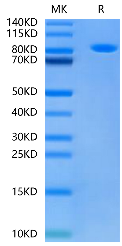 Human Alkaline Phosphatase (Germ type) on Tris-Bis PAGE under reduced condition. The purity is greater than 95%.Recombinant Human Alkaline Phosphatase (Germ type) /ALPG Protein, Active