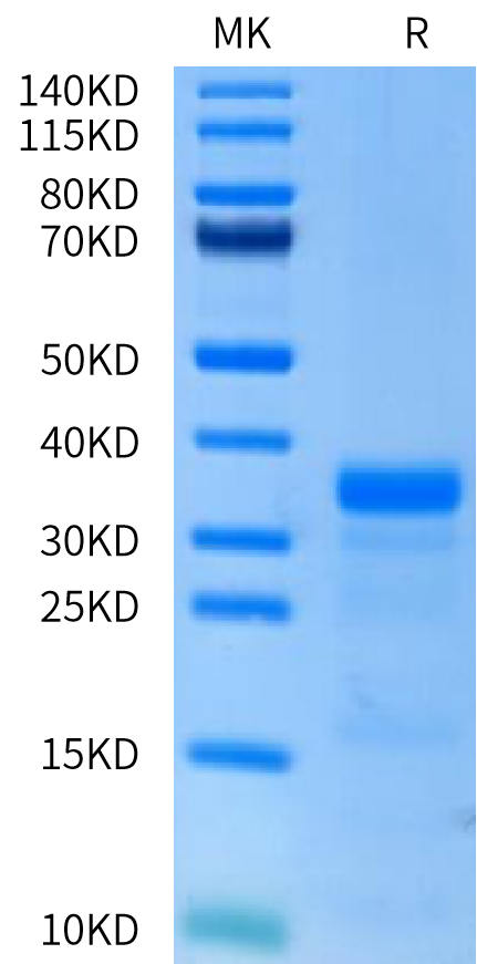 Human PLAU (activated by trypsin) on Tris-Bis PAGE under reduced condition. The purity is greater than 95%.Recombinant Human PLAU/uPA Protein (active form)