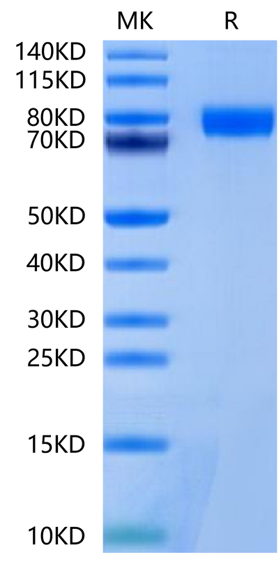 Mouse BCHE on Tris-Bis PAGE under reduced condition. The purity is greater than 95%.Recombinant Mouse BCHE/Butyrylcholinesterase Protein