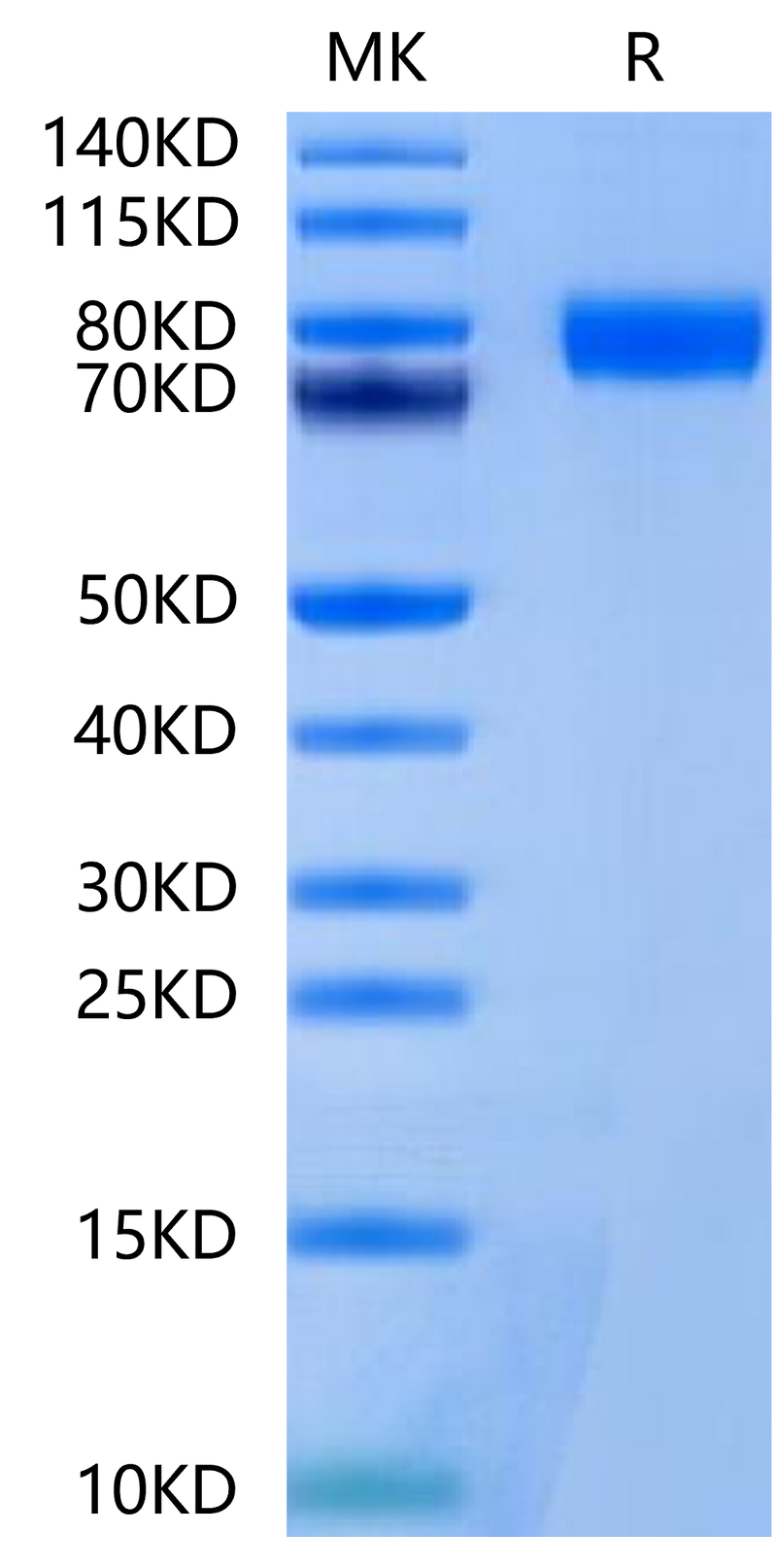 Mouse BCHE on Tris-Bis PAGE under reduced condition. The purity is greater than 95%.Recombinant Mouse BCHE/Butyrylcholinesterase Protein