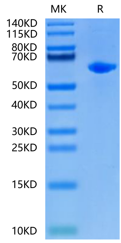 Rat Alkaline Phosphatase (Germ type) on Tris-Bis PAGE under reduced condition. The purity is greater than 95%.Recombinant Rat Alkaline Phosphatase (Germ type) /ALPG Protein