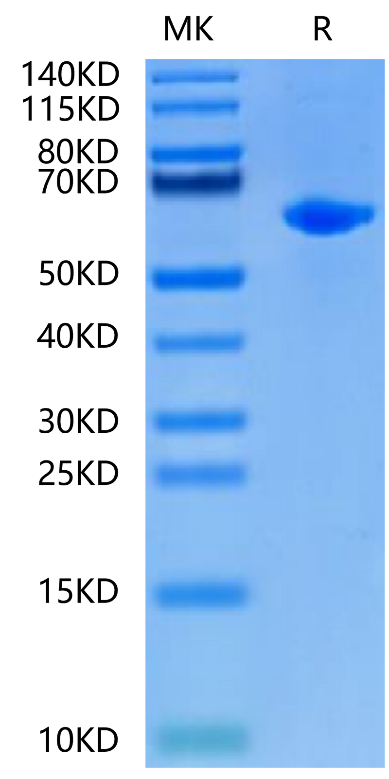 Rat Alkaline Phosphatase (Germ type) on Tris-Bis PAGE under reduced condition. The purity is greater than 95%.Recombinant Rat Alkaline Phosphatase (Germ type) /ALPG Protein