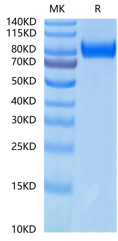 Rhesus macaque gp130 on Tris-Bis PAGE under reduced condition. The purity is greater than 95%.Recombinant Rhesus macaque gp130/CD130/IL-6 R beta Protein