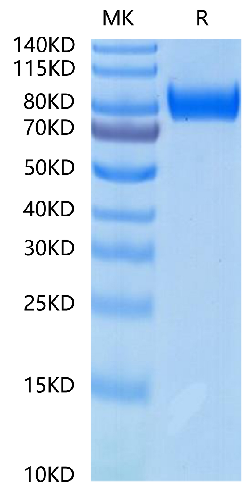 Rhesus macaque gp130 on Tris-Bis PAGE under reduced condition. The purity is greater than 95%.Recombinant Rhesus macaque gp130/CD130/IL-6 R beta Protein