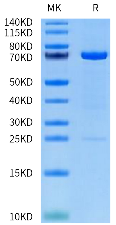 Human MMP-2 on Tris-Bis PAGE under reduced condition. The purity is greater than 95%.Recombinant Human MMP-2 Protein (pro form)