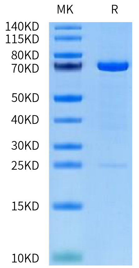 Human MMP-2 on Tris-Bis PAGE under reduced condition. The purity is greater than 95%.