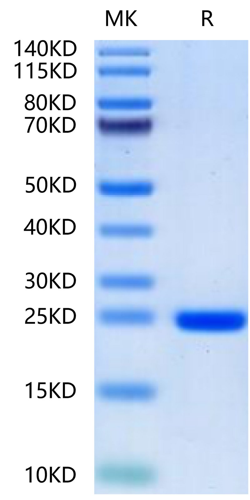 Human FGF8a-on Tris-Bis PAGE under reduced condition. The purity is greater than 95%.Recombinant Human FGF8a-Protein