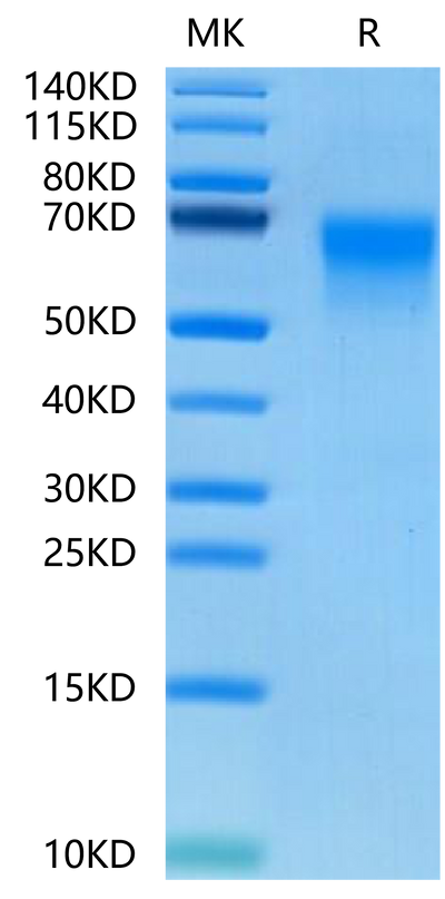 Human DKK3 on Tris-Bis PAGE under reduced conditions. The purity is greater than 95%.Recombinant Human DKK3 Protein
