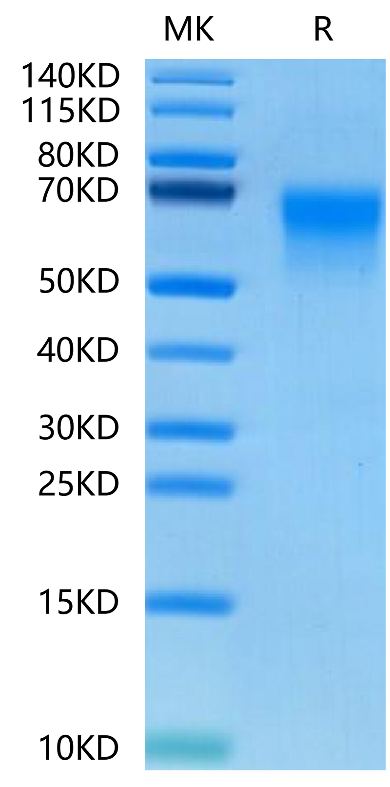 Human DKK3 on Tris-Bis PAGE under reduced conditions. The purity is greater than 95%.Recombinant Human DKK3 Protein