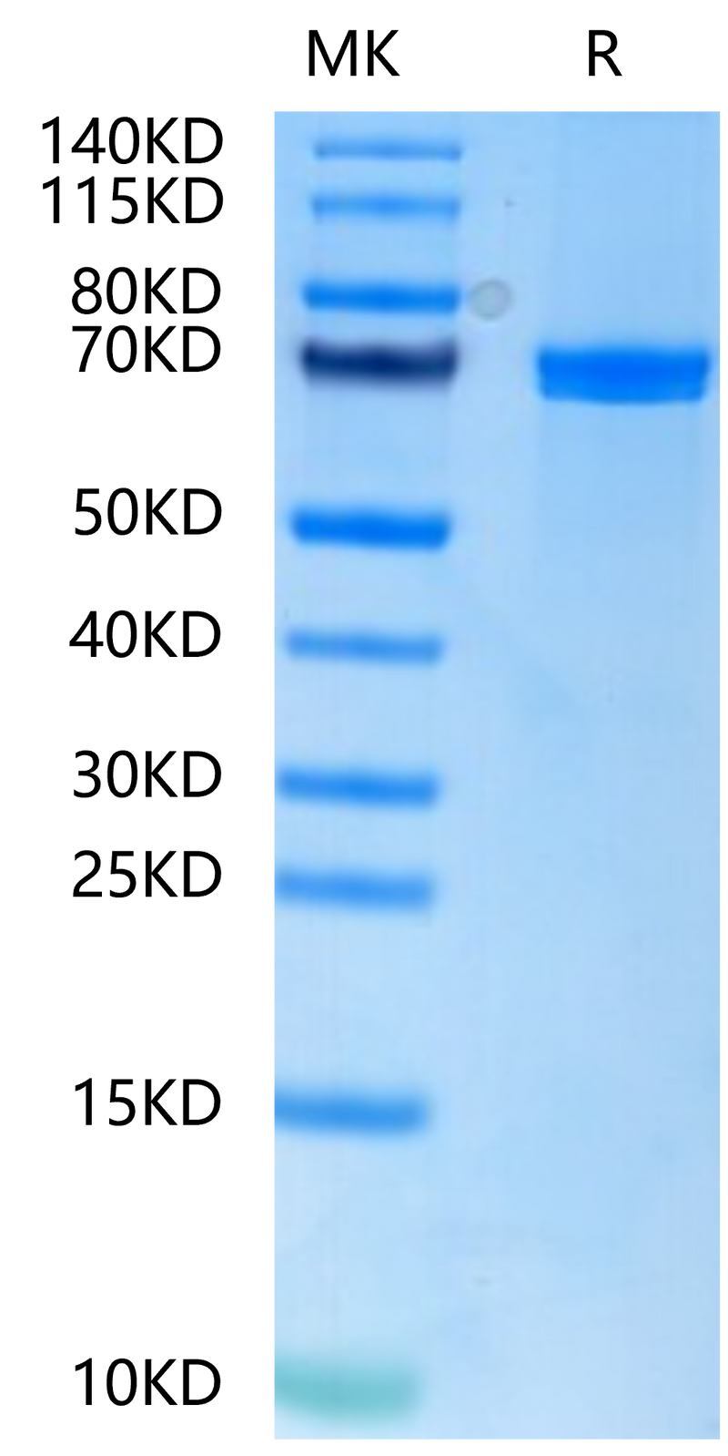 Human Wnt Surrogate-Fc Fusion on Tris-Bis PAGE under reduced condition. The purity is greater than 95%.Recombinant Human Wnt Surrogate-Fc Fusion Protein