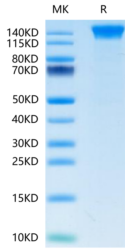 Human SEZ6 on Tris-Bis PAGE under reduced condition. The purity is greater than 95%.Recombinant Human SEZ6 Protein, Active
