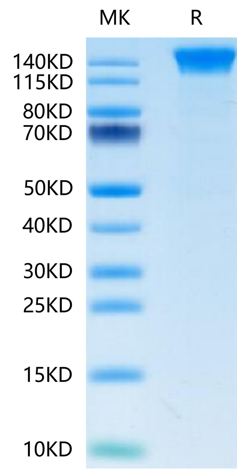Human SEZ6 on Tris-Bis PAGE under reduced condition. The purity is greater than 95%.Recombinant Human SEZ6 Protein, Active