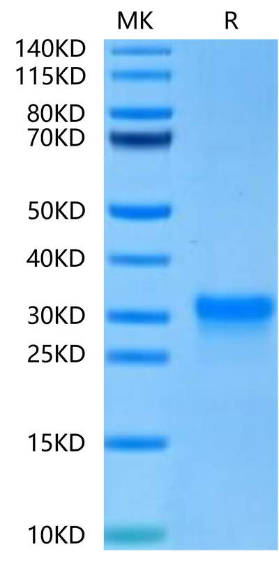 Human CD8 alpha on Tris-Bis PAGE under reduced condition. The purity is greater than 95%.Recombinant Human CD8 alpha/CD8A Protein, Active