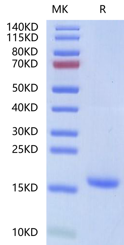 Human IL-18 on Tris-Bis PAGE under reduced condition. The purity is greater than 95%.Recombinant Human IL-18 Protein, Active