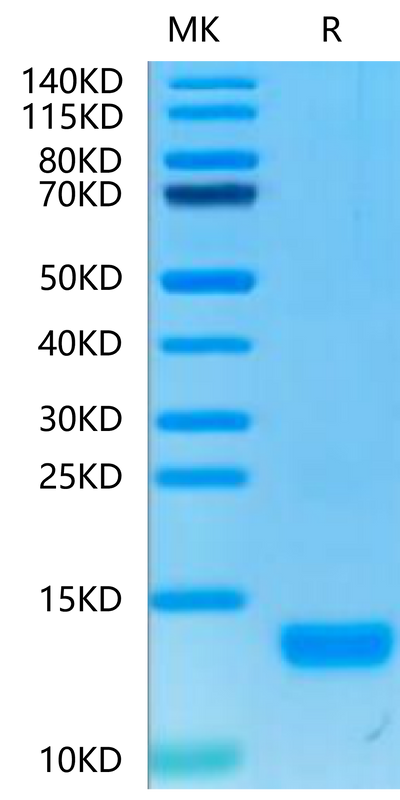 Human CXCL4 on Tris-Bis PAGE under reduced condition. The purity is greater than 95%.Recombinant Human CXCL4 Protein
